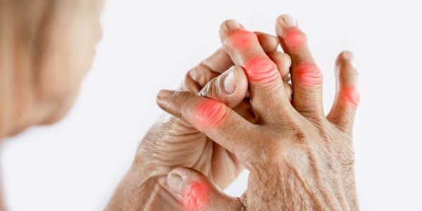 Can I Use CBD Balm for Pain Relief, Arthritis and Joint Pain?
